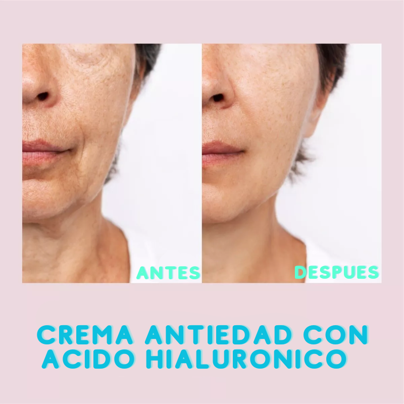 Hialuronika™💖: Crema anti-edad con Ácido Hialurónico