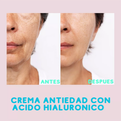 Hialuronika™💖: Crema anti-edad con Ácido Hialurónico